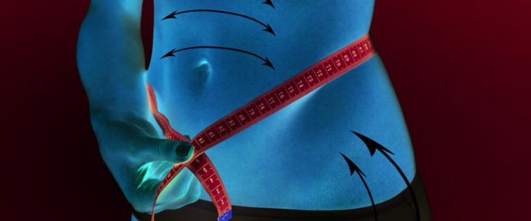 Reduce subcutaneous fat from the abdomen and flanks in one week of weight loss